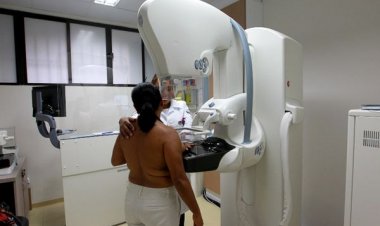 20 mil mamografias serão realizadas de graça na Bahia a partir de segunda (1); veja como agendar