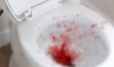 Mulher de 34 anos corta pênis do marido após descobrir traição