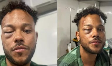 Publicitário é espancado por seguranças após acusação de furto no Festival de Verão